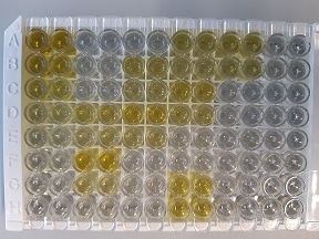 Human IFN-gamma Quantikine ELISA Kit DIF50C