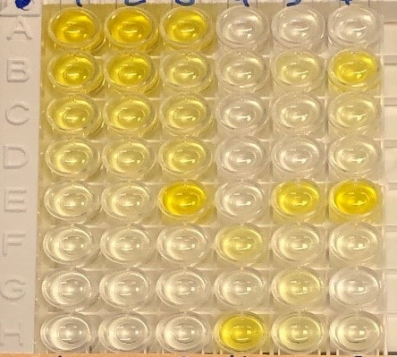 Human Urinary TIM-1/KIM-1/HAVCR Quantikine ELISA Kit DKM100