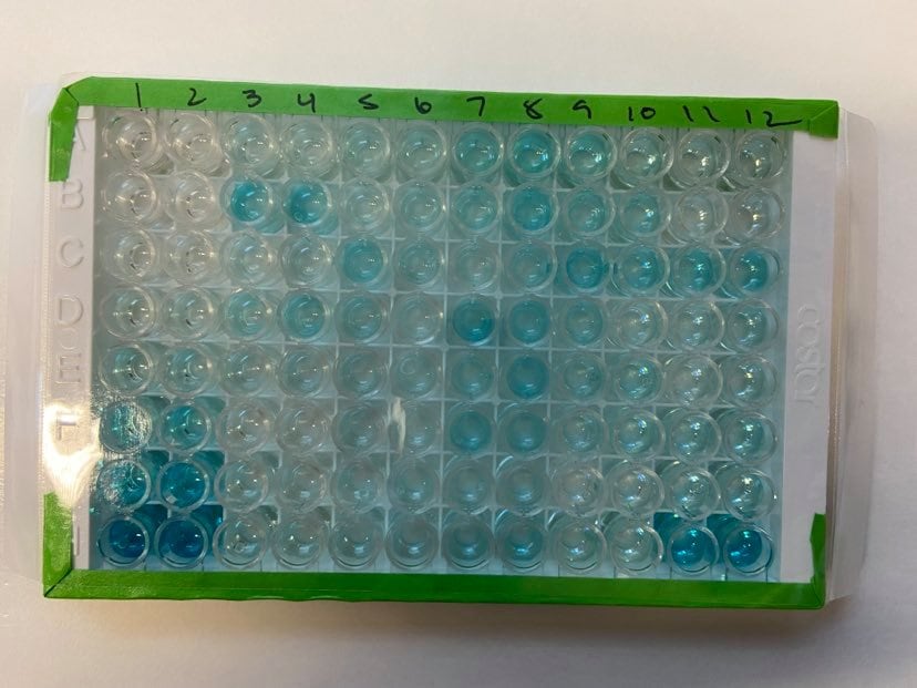 Human Total IL-18/IL-1F4 Quantikine ELISA Kit DL180