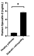 Human Lipocalin-2/NGAL Quantikine ELISA Kit DLCN20