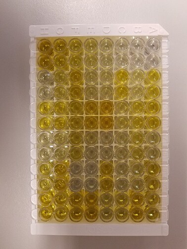 Human Serpin E1/PAI-1 Quantikine ELISA Kit DSE100