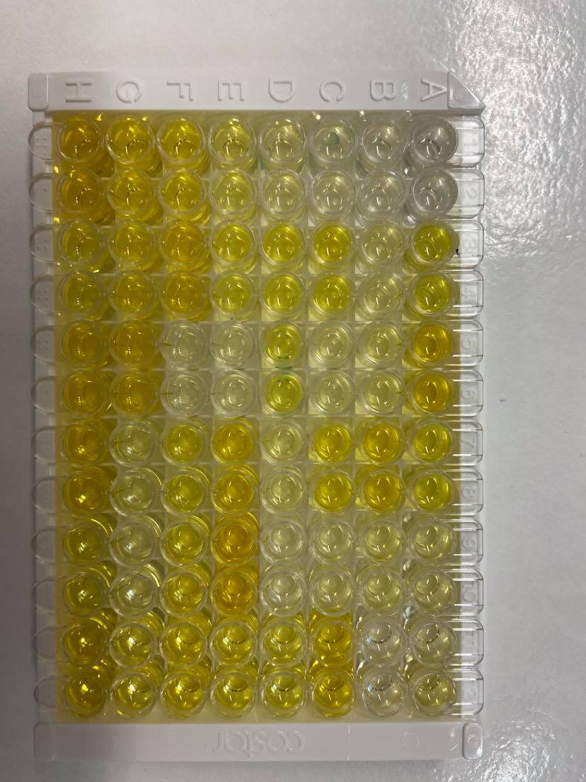 Human Serpin E1/PAI-1 Quantikine ELISA Kit DSE100
