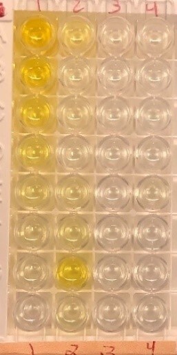 Human Serpin E1/PAI-1 Quantikine ELISA Kit DSE100