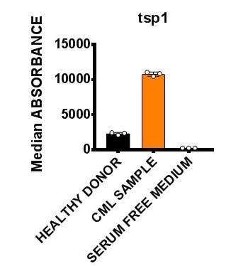 Human Thrombospondin-1 Quantikine ELISA Kit DTSP10
