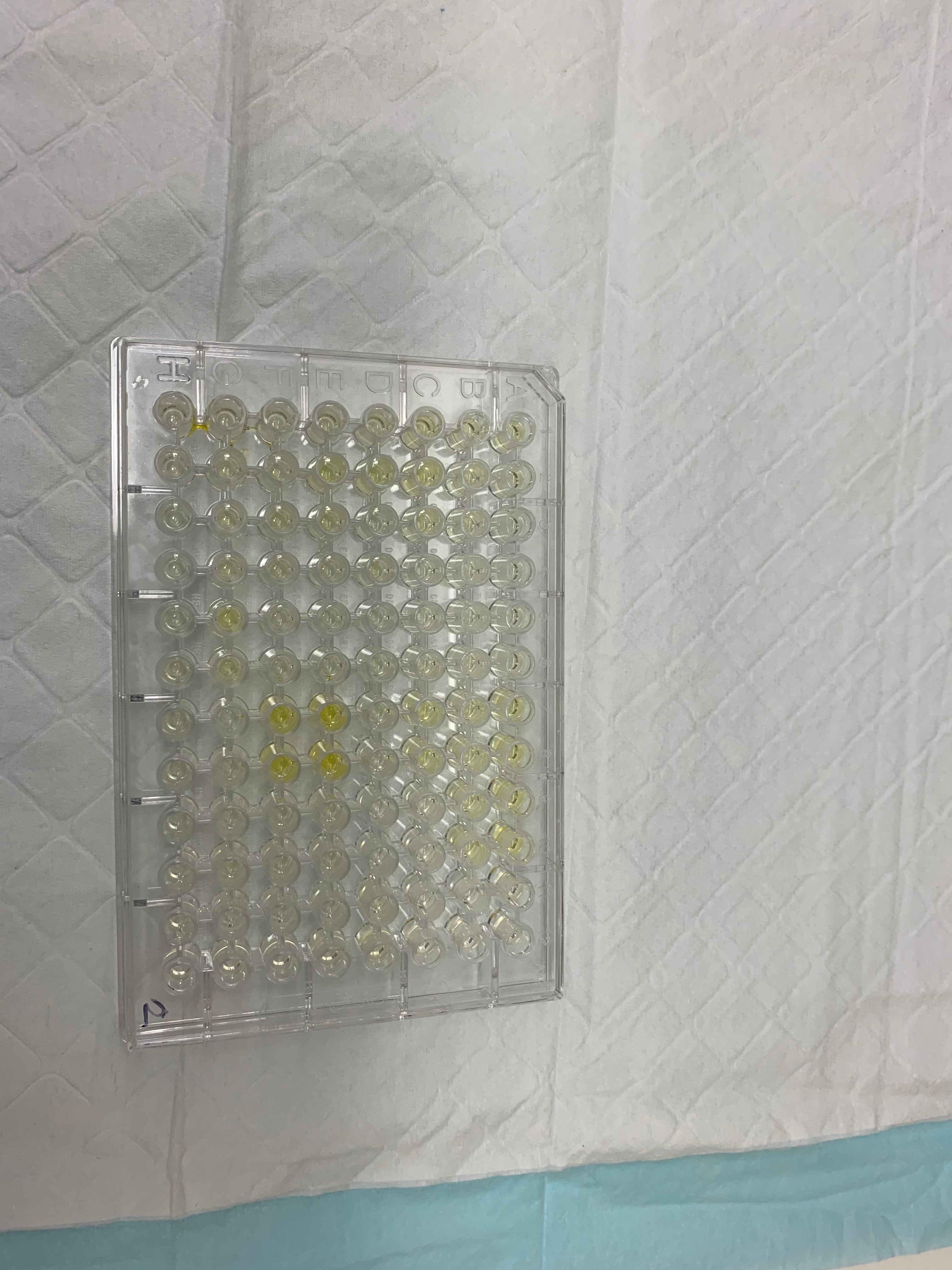 DuoSet ELISA Ancillary Reagent Kit 2 DY008