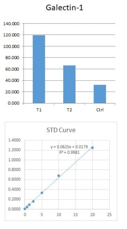Human Galectin-1 DuoSet ELISA DY1152-05
