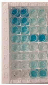 Human C-Reactive Protein/CRP DuoSet ELISA DY1707
