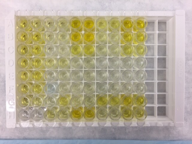 Human LOX-1/OLR1 DuoSet ELISA DY1798