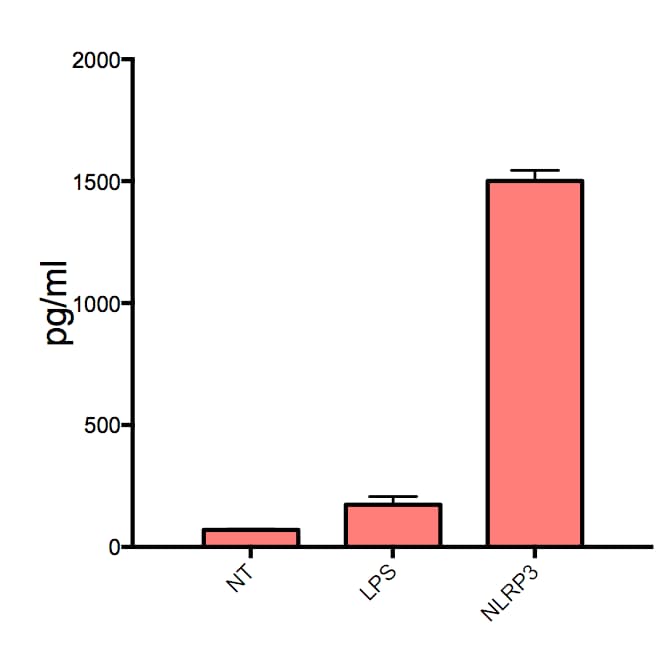 Human IL-1 beta/IL-1F2 DuoSet ELISA DY201