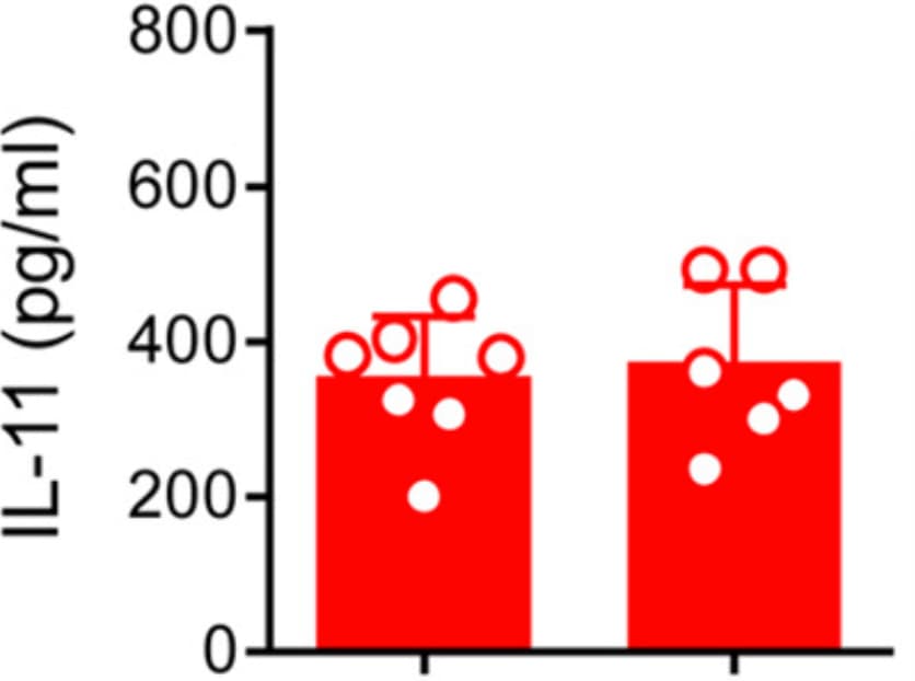 Human IL-11 DuoSet ELISA DY218