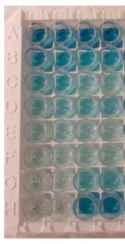Human alpha 1-Acid Glycoprotein DuoSet ELISA DY3694