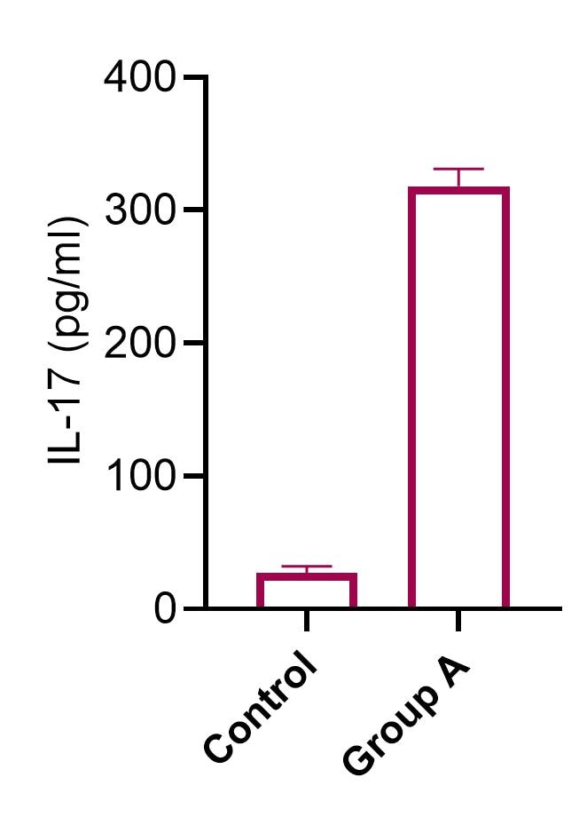 Mouse IL-17 DuoSet ELISA DY421