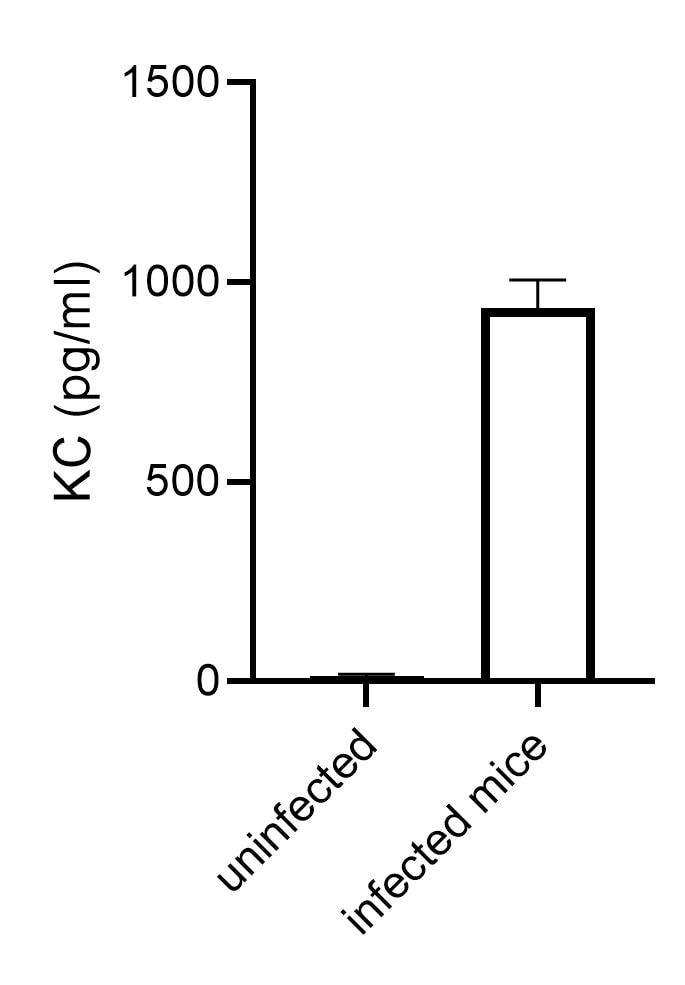 Mouse CXCL1/KC DuoSet ELISA DY453