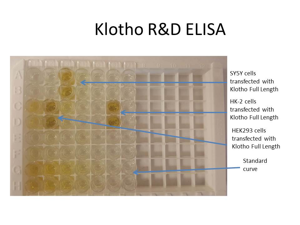 Human Klotho DuoSet ELISA DY5334-05