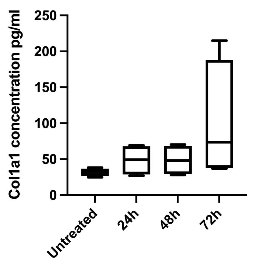 Human Pro-Collagen I alpha 1 DuoSet ELISA DY6220-05