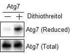 Recombinant Human His6-ATG7 Isoform 1 Protein, CF E-318