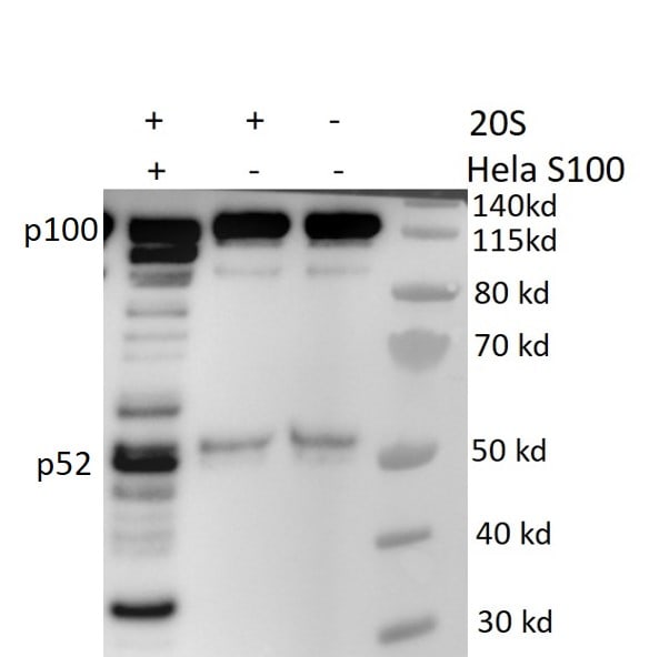 Human 20S Proteasome Protein, CF E-360