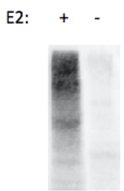 Recombinant Human/Mouse/Rat UbcH7/UBE2L3 Protein, CF E2-640