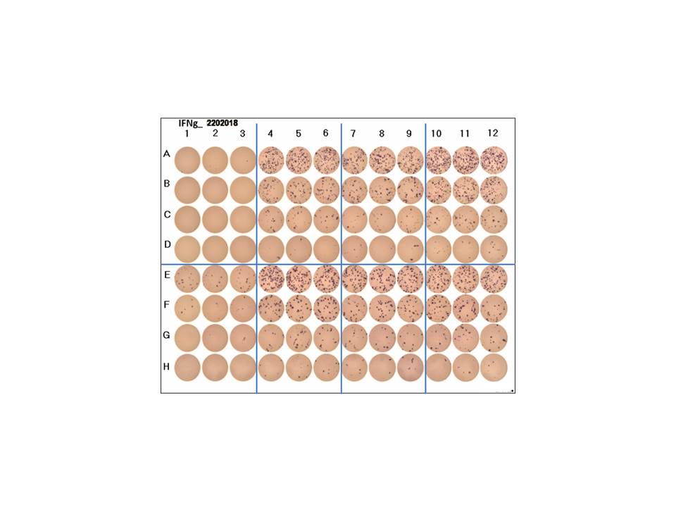Human IFN-gamma ELISpot Kit EL285