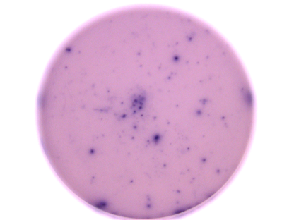 Human IFN-gamma ELISpot Kit EL285