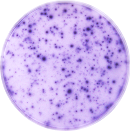 Human IFN-gamma ELISpot Kit EL285