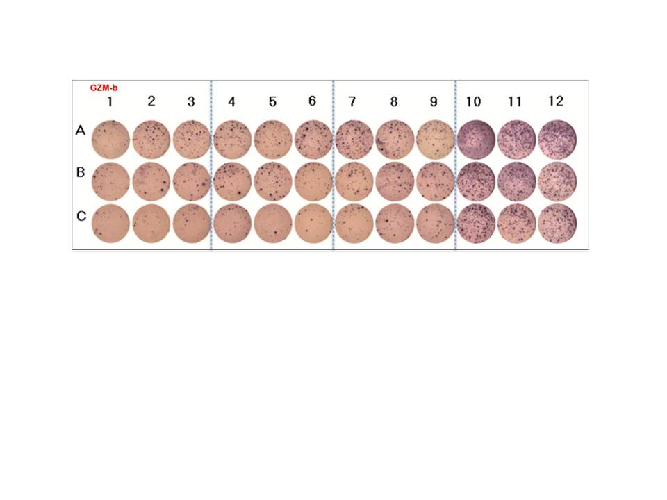 Human Granzyme B ELISpot Kit EL2906