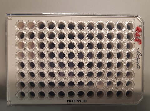 Human Granzyme B ELISpot Kit EL2906