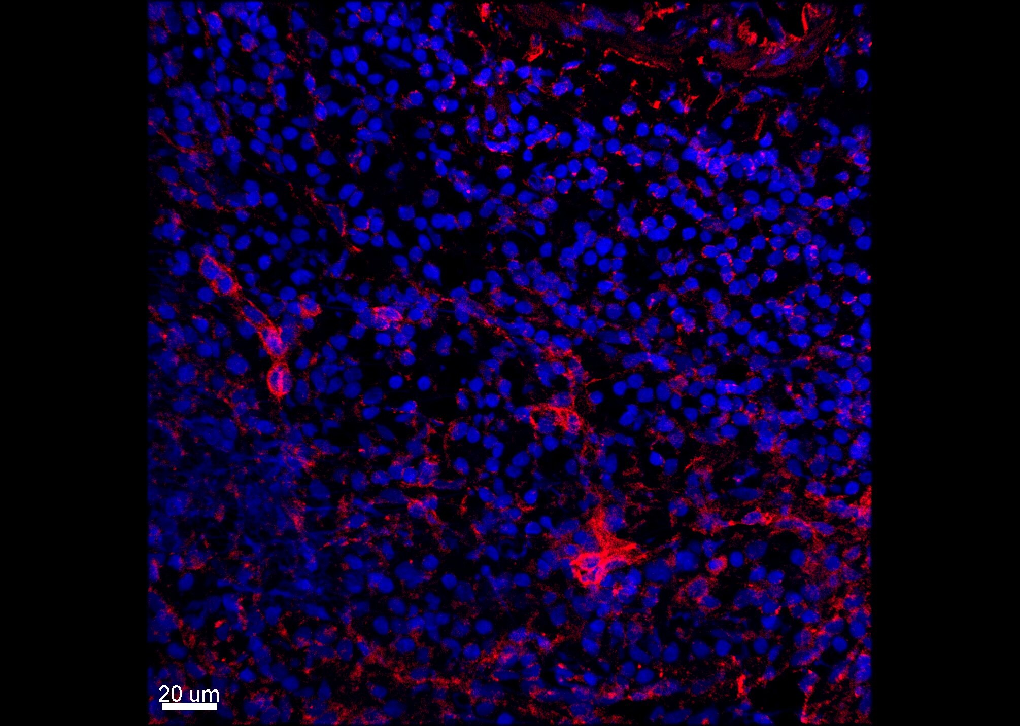 Human Siglec-3/CD33 Alexa Fluor® 594-conjugated Antibody FAB1137T
