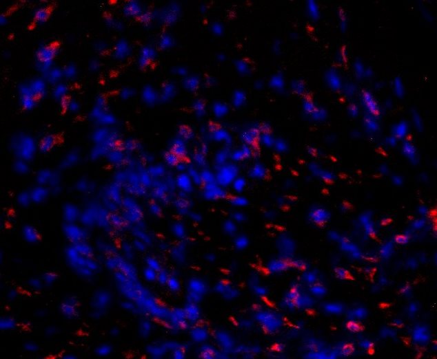 Human TNF RI/TNFRSF1A PE‑conjugated Antibody FAB225P