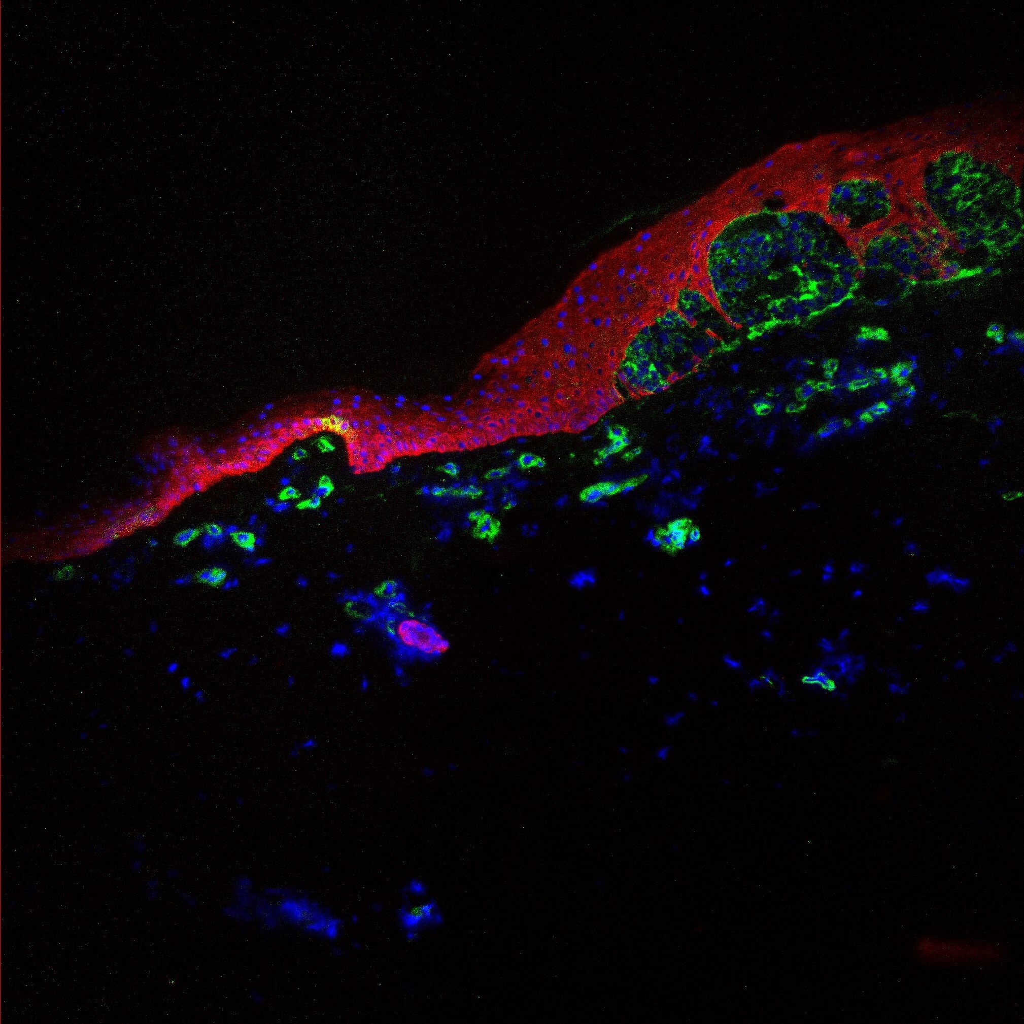 Human NG2/MCSP Fluorescein‑conjugated Antibody FAB2585F