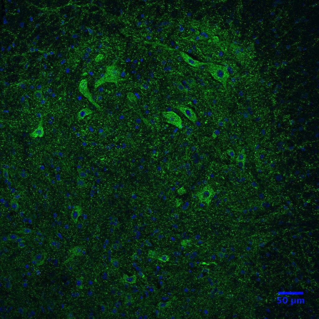 Mouse TGF‑ beta  RII Fluorescein‑conjugated Antibody FAB532F