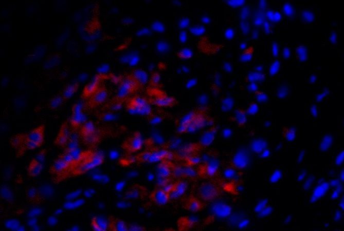 Mouse L1CAM PE‑conjugated Antibody FAB5674P