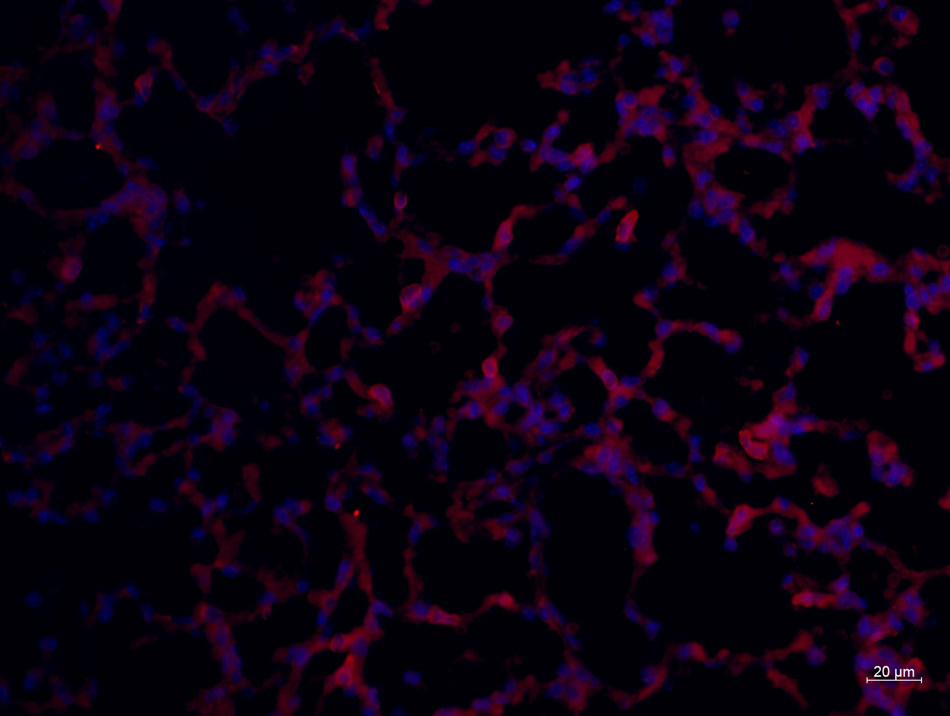 Mouse E‑Cadherin PE‑conjugated Antibody FAB7481P