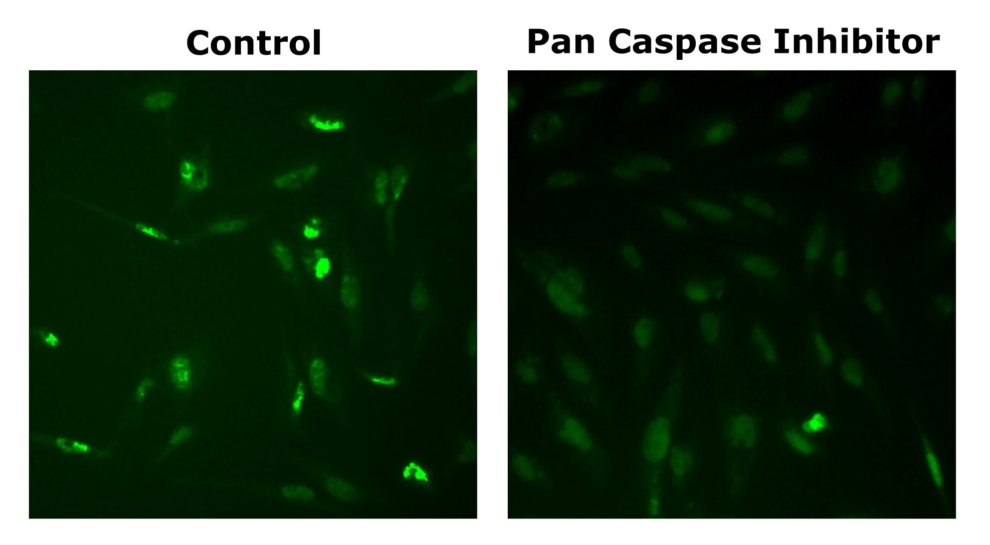 Pan Caspase Inhibitor Z-VAD-FMK FMK001
