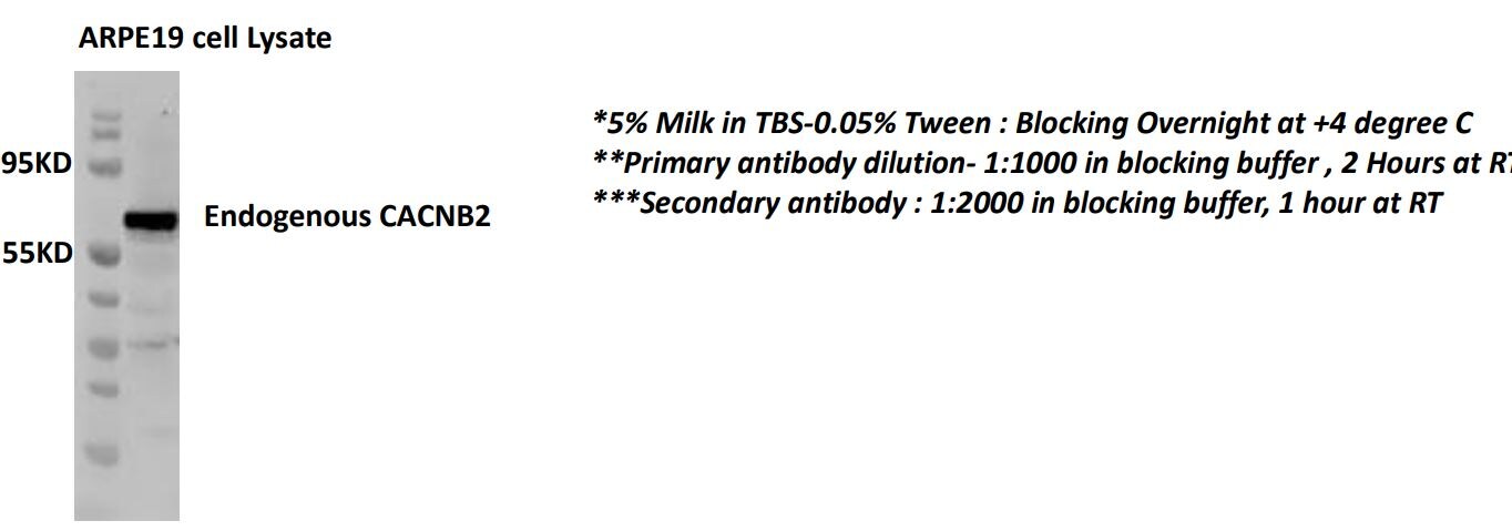 CACNB2 Antibody (6C4) - Azide and BSA Free H00000783-M05