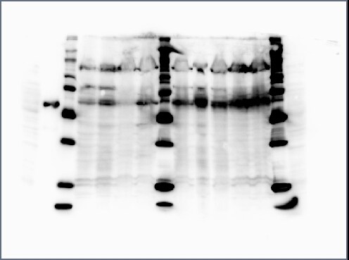 Glucosylceramidase/GBA Antibody (2E2) - Azide and BSA Free H00002629-M01