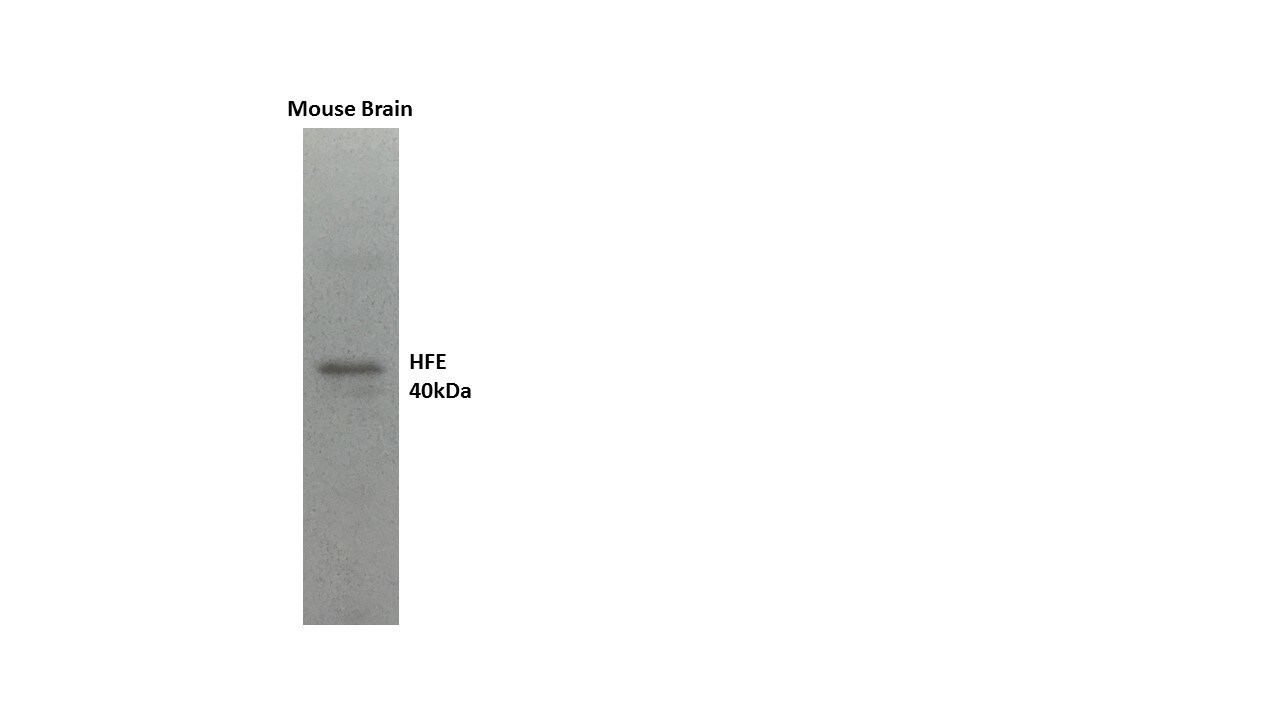HFE Antibody (1G12) - Azide and BSA Free H00003077-M01