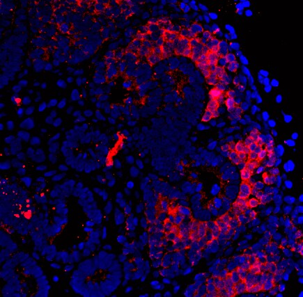 CITED1 Antibody (5H6) - Azide and BSA Free H00004435-M03