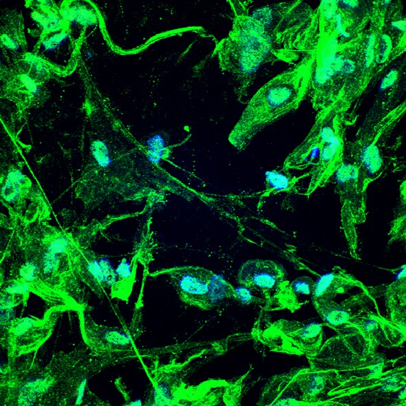 Myocilin Antibody (4F8) - Azide and BSA Free H00004653-M01