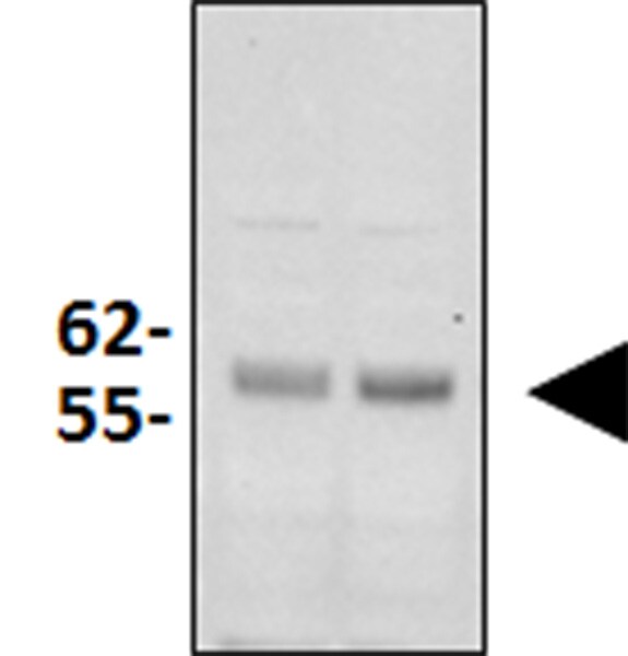 Parkin Antibody (1H4) - Azide and BSA Free H00005071-M01