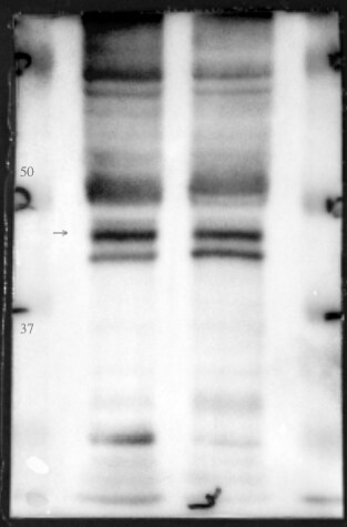 PDK3 Antibody (3A1) - Azide and BSA Free H00005165-M02