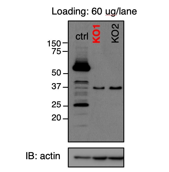 p62/SQSTM1 Antibody (2C11) - Azide and BSA Free H00008878-M01