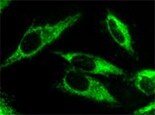 p62/SQSTM1 Antibody (2C11) - Azide and BSA Free H00008878-M01
