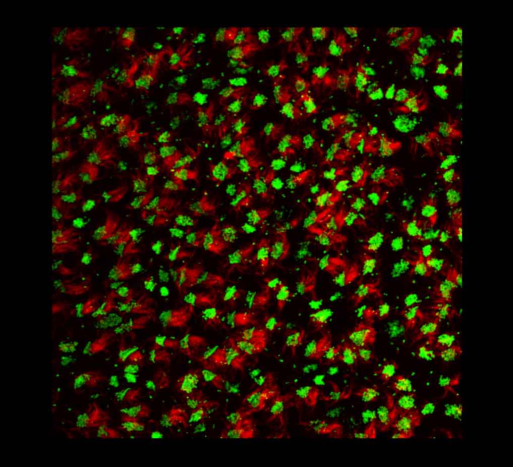 FGFR1OP Antibody (2B1) - Azide and BSA Free H00011116-M01