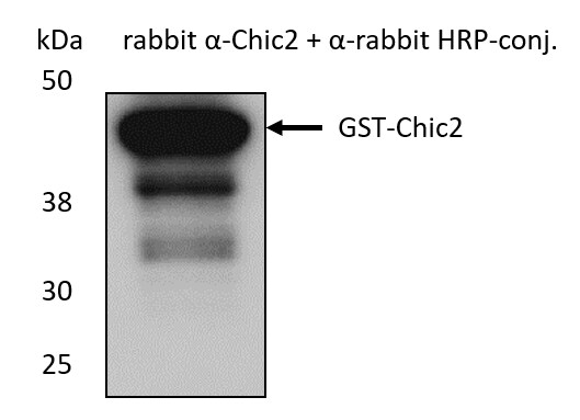 Recombinant Human CHIC2 GST (N-Term) Protein H00026511-P01