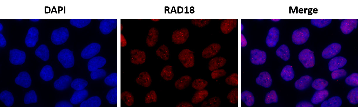 RAD18 Antibody (3H7) - Azide and BSA Free H00056852-M01
