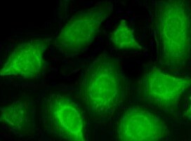 ANKRA2 Antibody (1D11) - Azide and BSA Free H00057763-M01