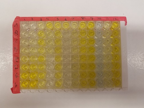 Human IL-6 Quantikine HS ELISA HS600C