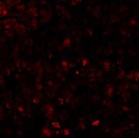 Mouse CXCL1/GRO alpha/KC/CINC-1 Alexa Fluor® 594-conjugated Antibody IC4532T
