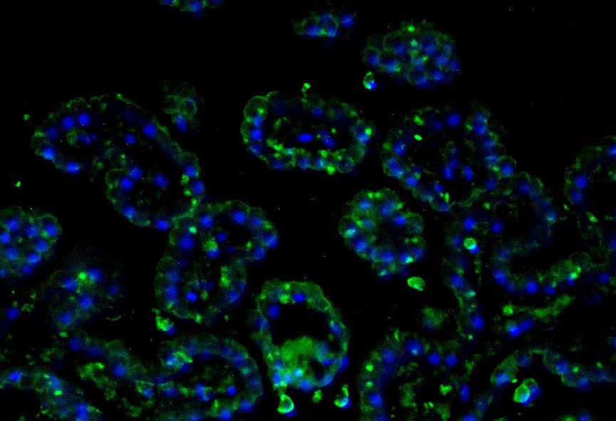Human MMP‑9 Fluorescein‑conjugated Antibody IC9111F